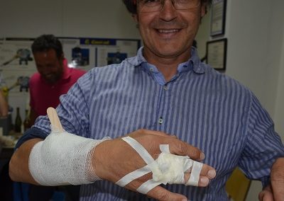 EFR